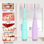 Electric Ultrasonic Sonic Dental Scaler Tooth Calculus Remover – Bild 2