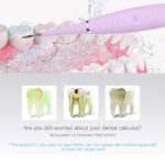 Electric Ultrasonic Sonic Dental Scaler Tooth Calculus Remover – Bild 4