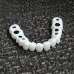 Whitening Braces Simulation Teeth Denture Brace – Bild 2