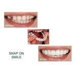 Whitening Braces Simulation Teeth Denture Brace – Bild 5